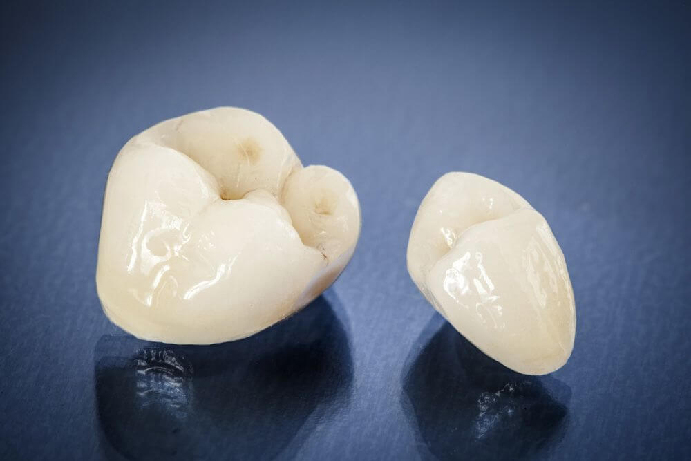 Replace decayed teeth with a dental crown